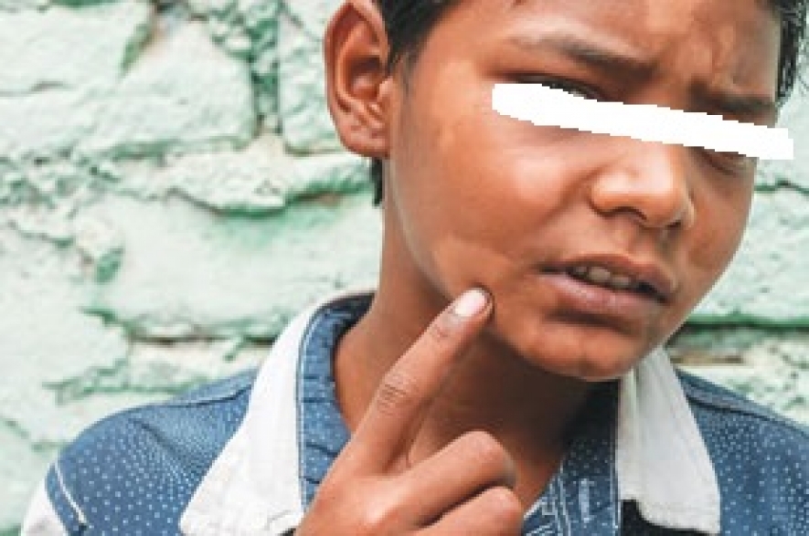 නිසි ප්රතිකාර කිරීමෙන් ලාදුරු රෝගය සුව කළ හැක. නිසි ප්රතිකාර කිරීමෙන් ලාදුරු රෝගය සුව කළ හැක.