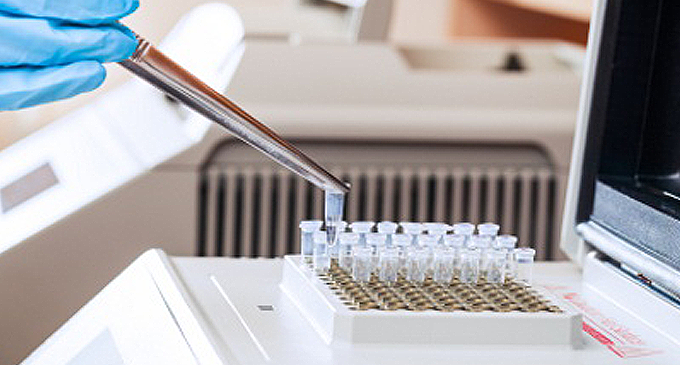 PCR පරීක්ෂණ ගණන තවත් වැඩි කෙරේ PCR පරීක්ෂණ ගණන තවත් වැඩි කෙරේ
