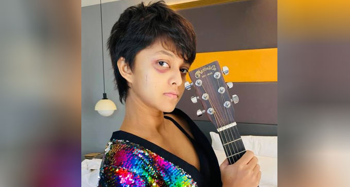 ගිටාරෙට මූණ තුවාල වුණැයි යොහානි සමාජ මාධ්ය වෙත දන්වයි ගිටාරෙට මූණ තුවාල වුණැයි යොහානි සමාජ මාධ්ය වෙත දන්වයි
